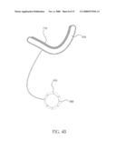 PERICARDIAL INSERTS diagram and image