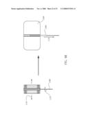 PERICARDIAL INSERTS diagram and image