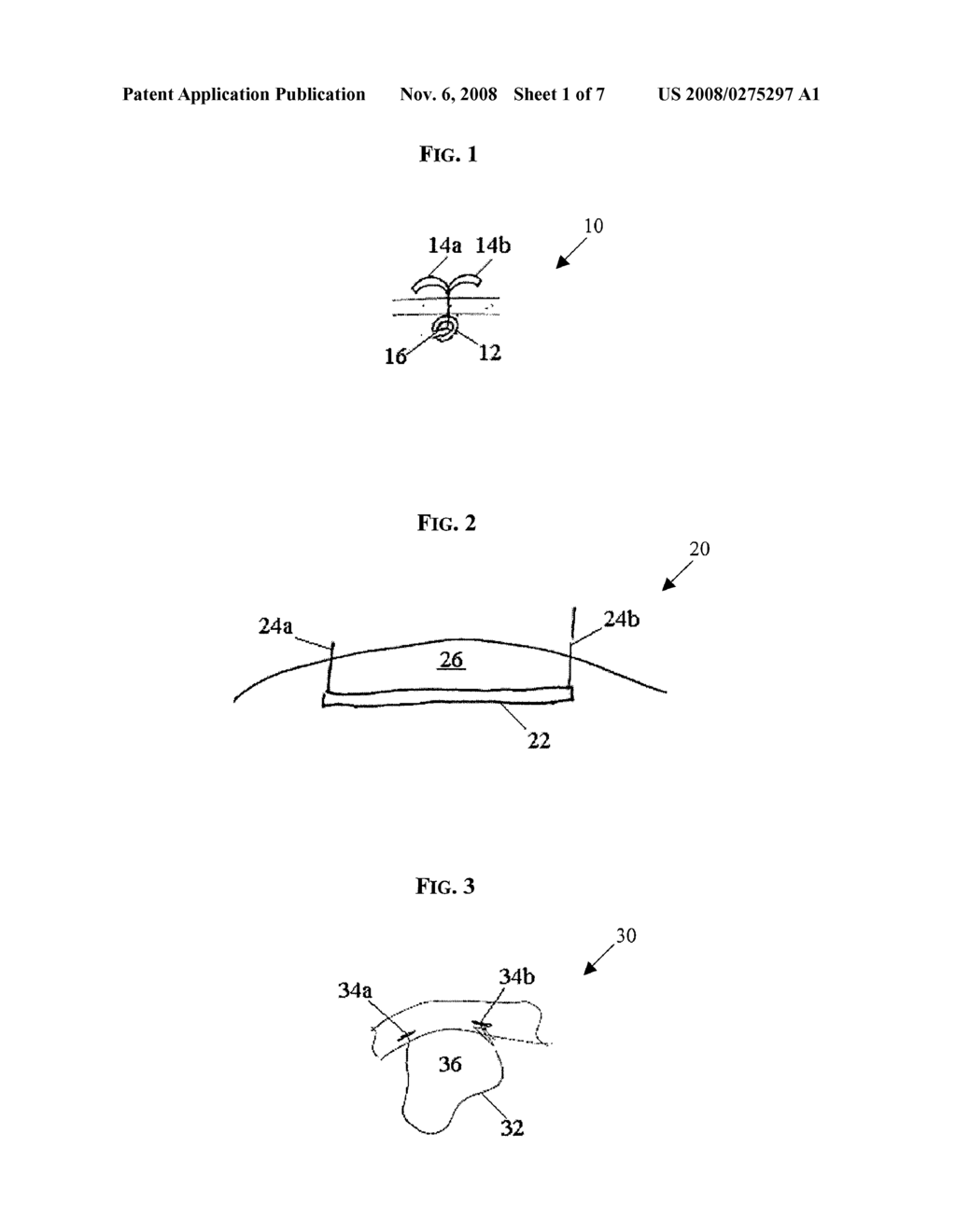 ENDOSCOPIC GUIDE DEVICE - diagram, schematic, and image 02