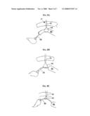 ENDOSCOPIC GUIDE DEVICE diagram and image