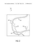 Methods and apparatus for virtual coronary mapping diagram and image