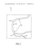 Methods and apparatus for virtual coronary mapping diagram and image