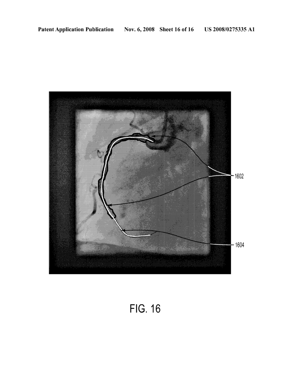 Methods and apparatus for virtual coronary mapping - diagram, schematic, and image 17