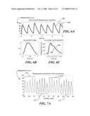 ULTRASONIC TISSUE DISPLACEMENT/STRAIN IMAGING OF BRAIN FUNCTION diagram and image