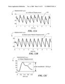 ULTRASONIC TISSUE DISPLACEMENT/STRAIN IMAGING OF BRAIN FUNCTION diagram and image