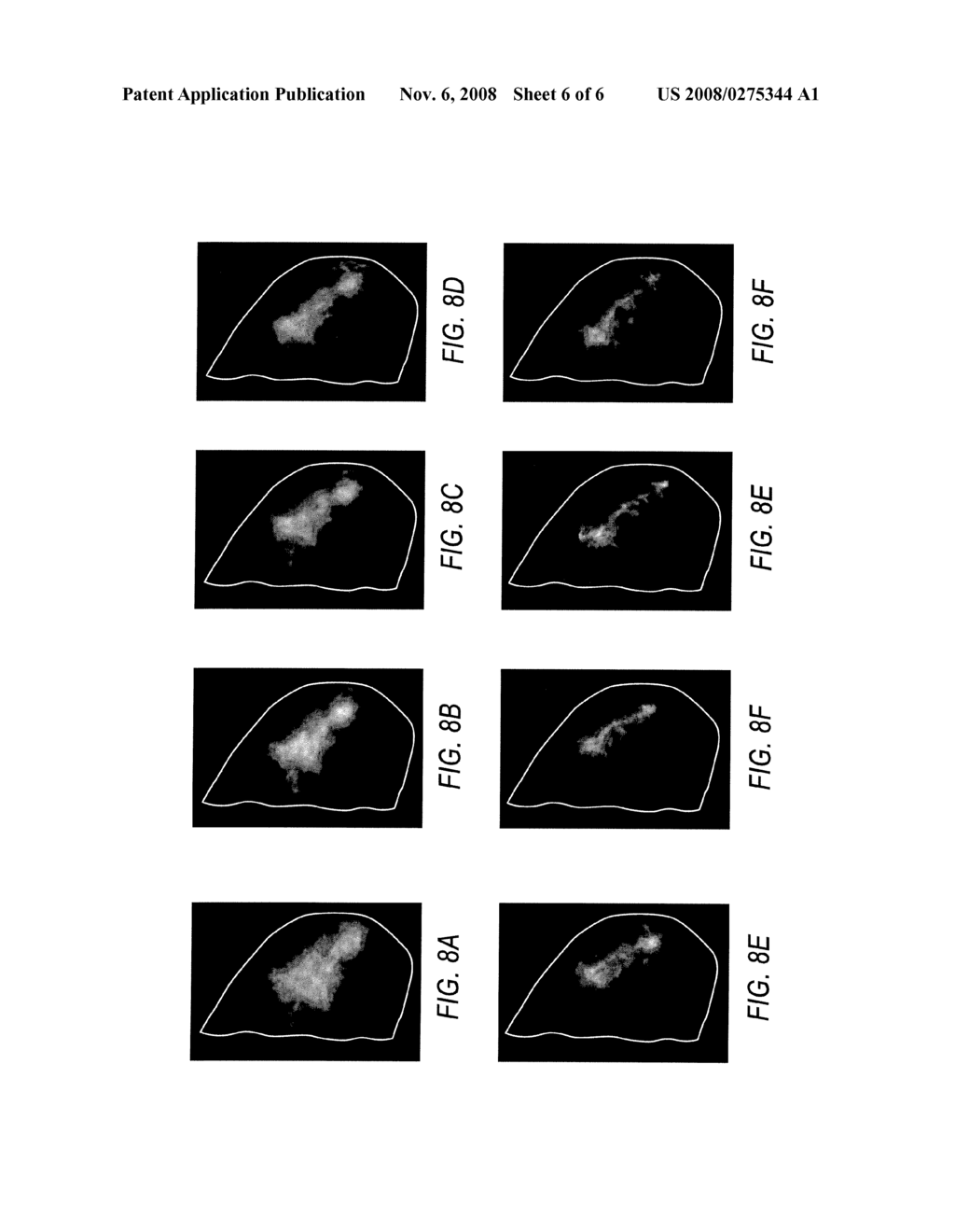 Method and Apparatus for Categorizing Breast Density and Assessing Cancer Risk Utilizing Acoustic Parameters - diagram, schematic, and image 07