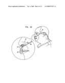 Oral/nasal cannula diagram and image