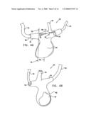 Oral/nasal cannula diagram and image