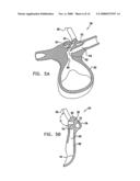 Oral/nasal cannula diagram and image