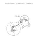 Oral/nasal cannula diagram and image