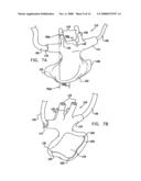 Oral/nasal cannula diagram and image