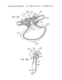 Oral/nasal cannula diagram and image