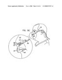 Oral/nasal cannula diagram and image