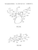 Oral/nasal cannula diagram and image