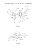 Oral/nasal cannula diagram and image