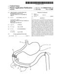 Arrangement and Method for Determining Muscular Contractions in an Anatomical Organ diagram and image