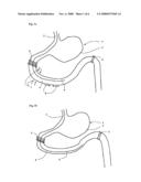 Arrangement and Method for Determining Muscular Contractions in an Anatomical Organ diagram and image