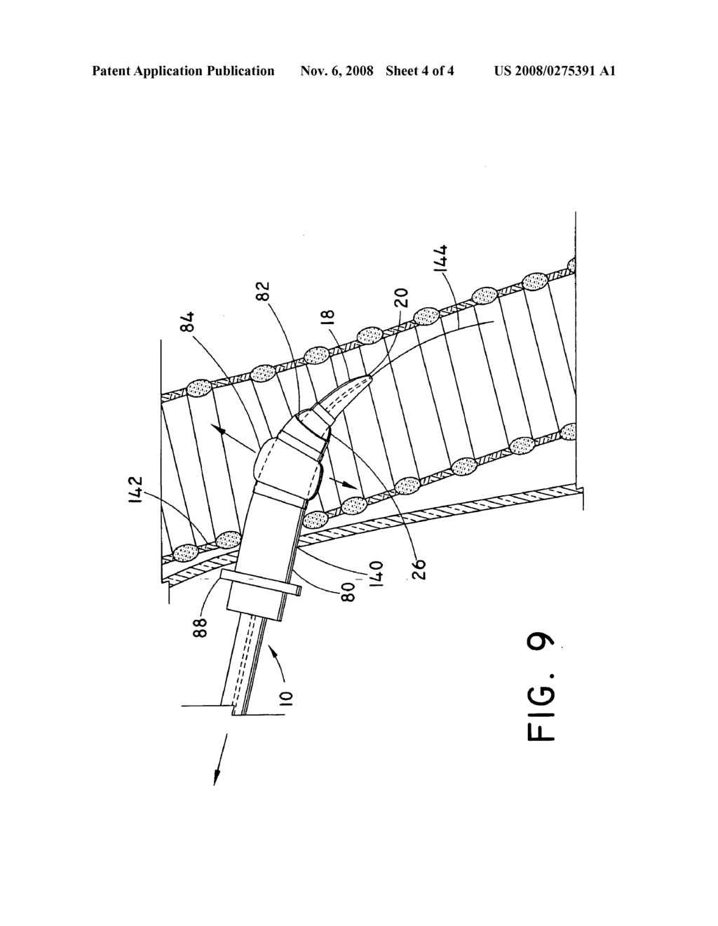 Loading dilator with transition baloon - diagram, schematic, and image 05