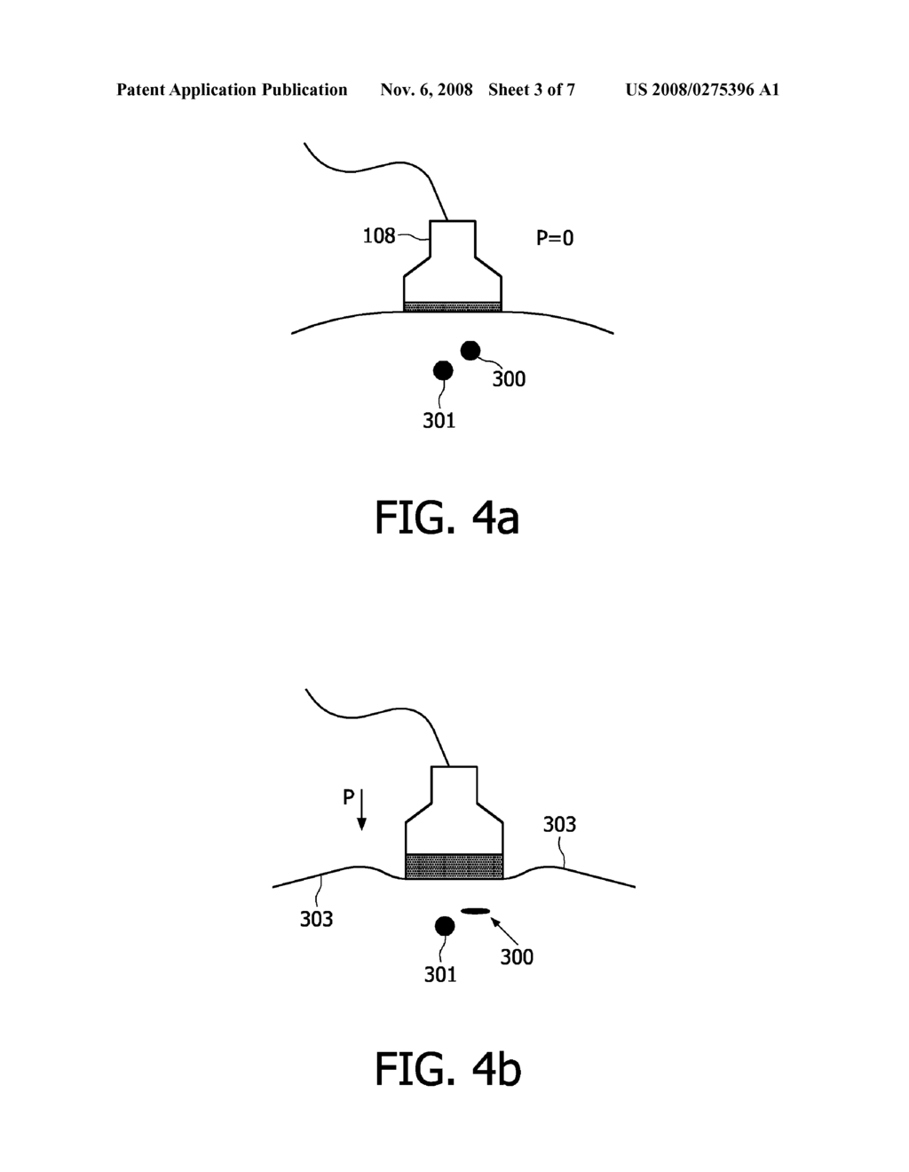 Cannula Inserting System - diagram, schematic, and image 04