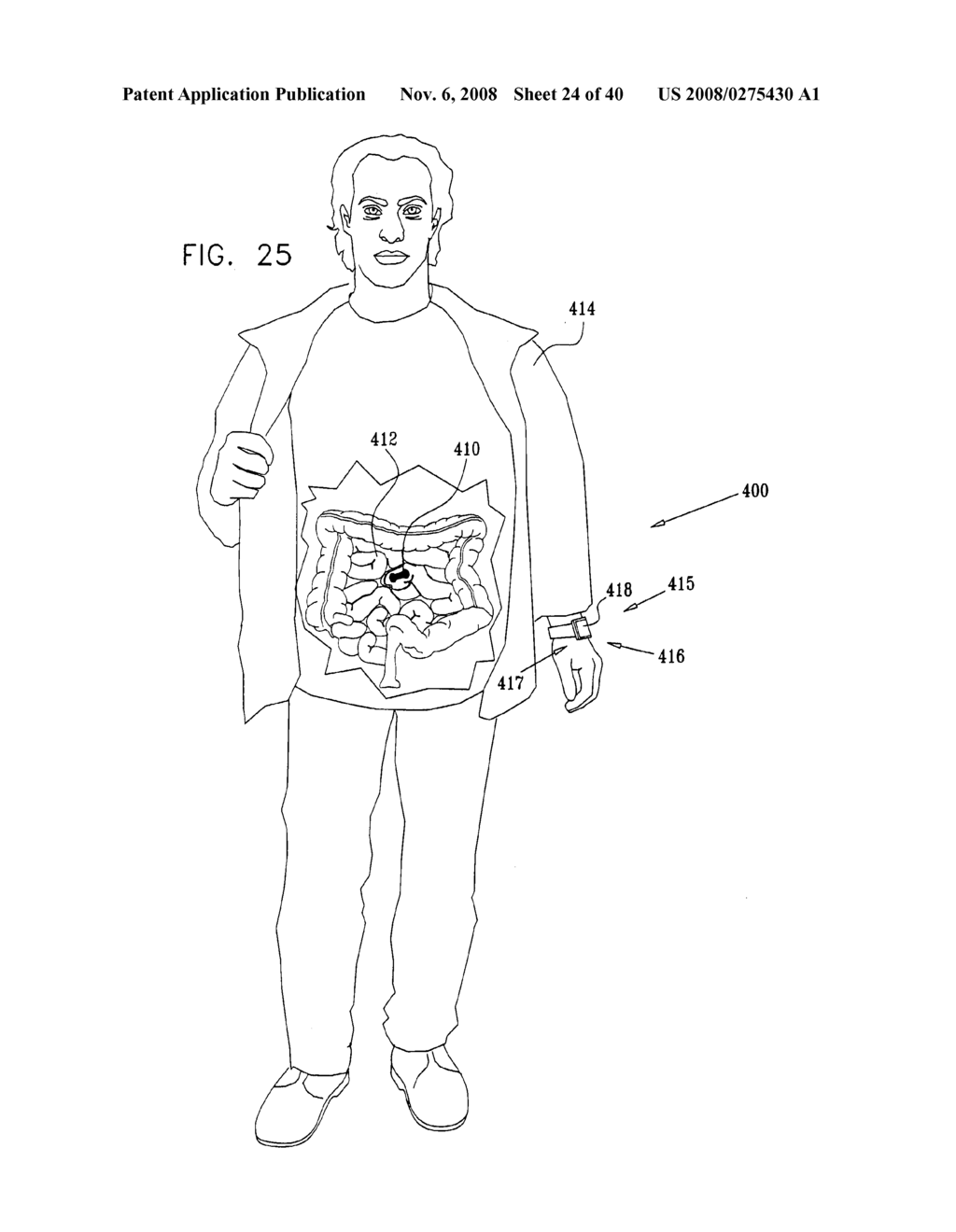 Prolonged Transit Time of Permeability-Enhancing Drug Eluting Pill - diagram, schematic, and image 25