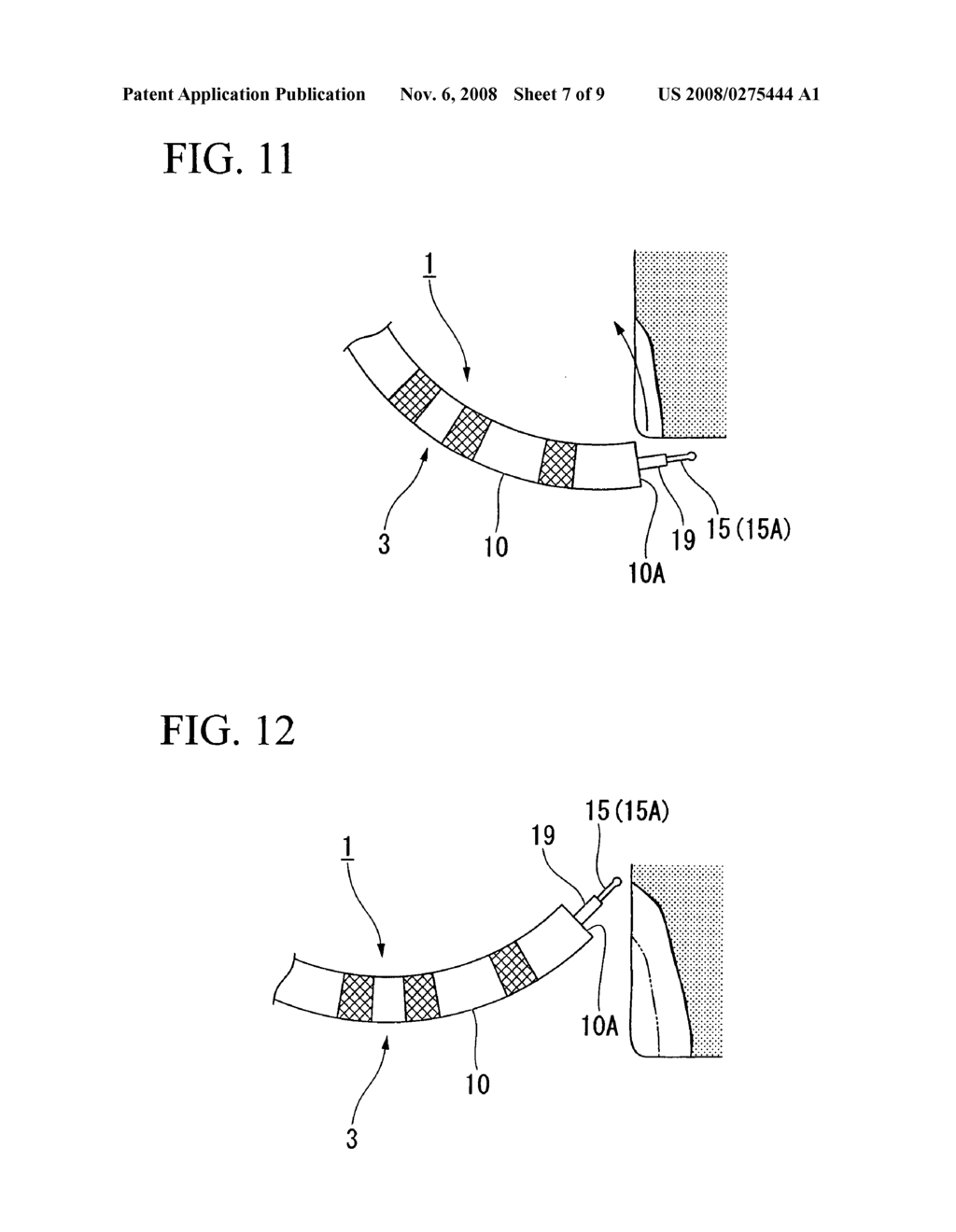 Endoscopic treatment instrument and tissue incision method - diagram, schematic, and image 08