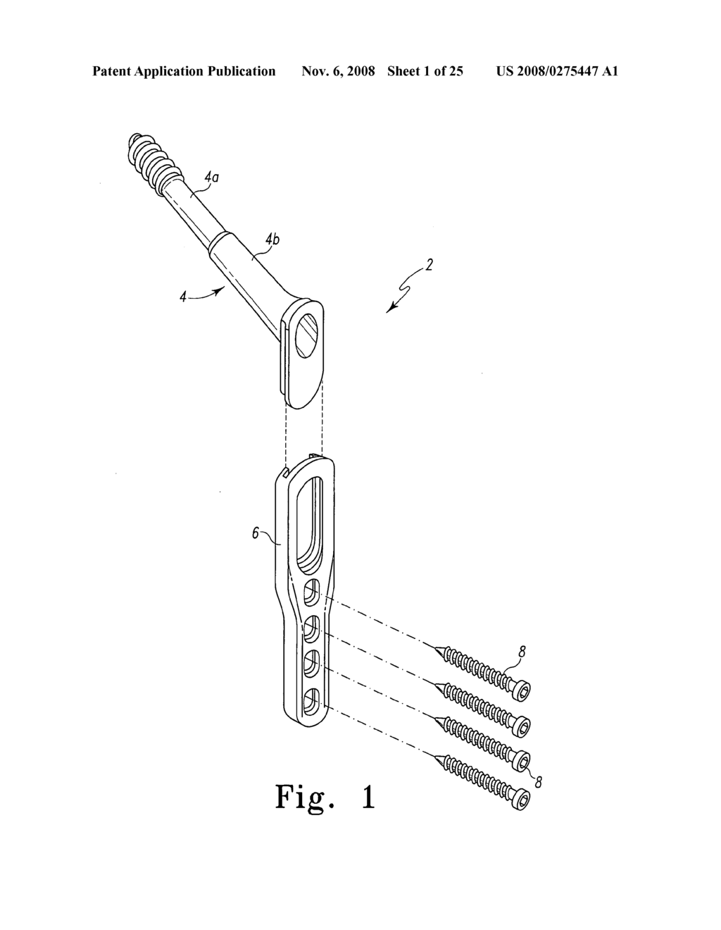 Assembly for minimally invasive reduction of hip fracture - diagram, schematic, and image 02