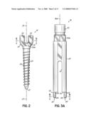 INSTALLATION SYSTEMS FOR SPINAL STABILIZATION SYSTEM AND RELATED METHODS diagram and image