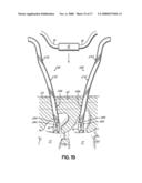 INSTALLATION SYSTEMS FOR SPINAL STABILIZATION SYSTEM AND RELATED METHODS diagram and image