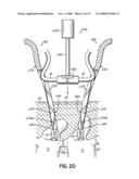 INSTALLATION SYSTEMS FOR SPINAL STABILIZATION SYSTEM AND RELATED METHODS diagram and image