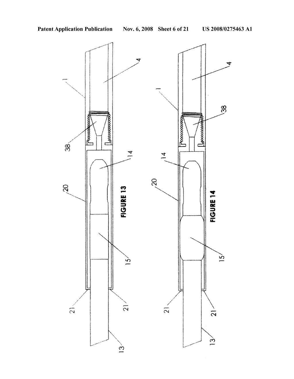 CYSTOTOMY CATHETER CAPTURE DEVICE AND METHODS OF USING SAME - diagram, schematic, and image 07