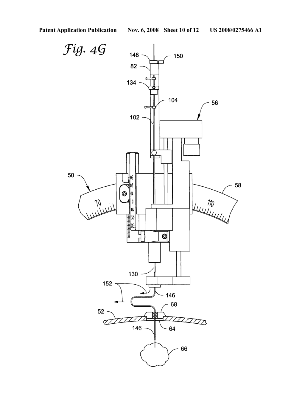 Dual cannula system and method for using same - diagram, schematic, and image 11