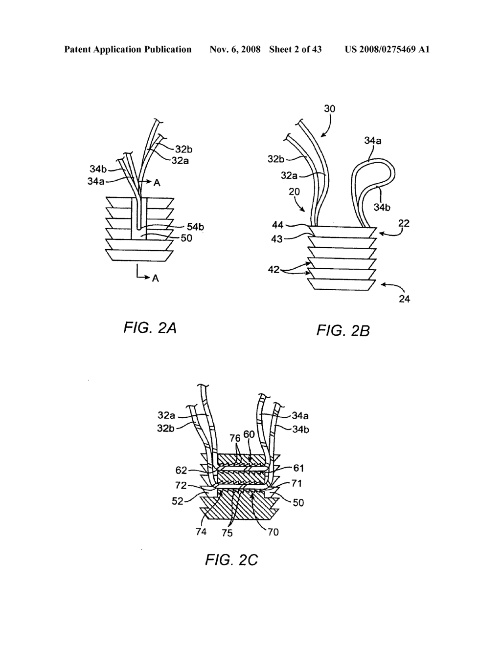 Tack anchor systems, bone anchor systems, and methods of use - diagram, schematic, and image 03