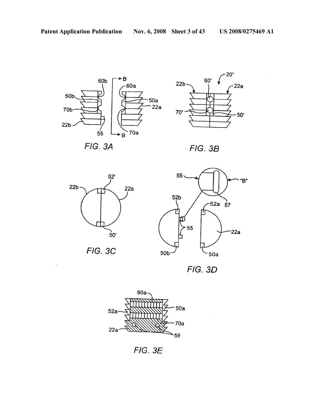 Tack anchor systems, bone anchor systems, and methods of use - diagram, schematic, and image 04