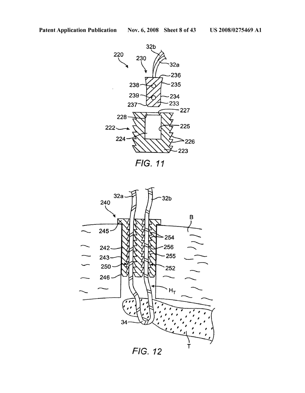 Tack anchor systems, bone anchor systems, and methods of use - diagram, schematic, and image 09