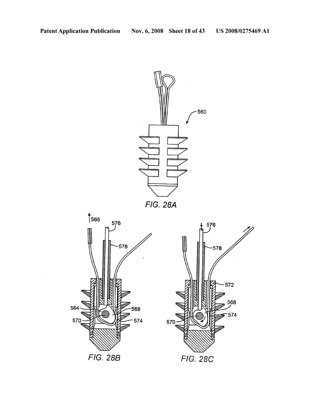 Tack anchor systems, bone anchor systems, and methods of use - diagram, schematic, and image 19