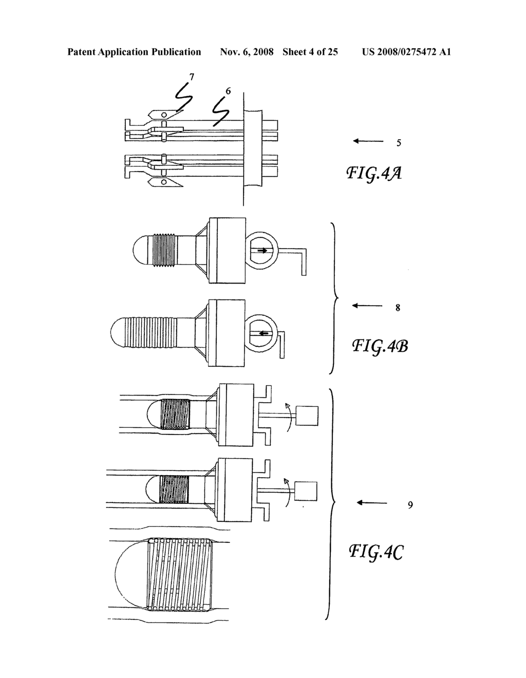 Assisted Apparatus for Anastomosis and Method Thereby of Reconnecting the Urethra to the Bladder After Removal of the Prostate During a Prostatectomy - diagram, schematic, and image 05