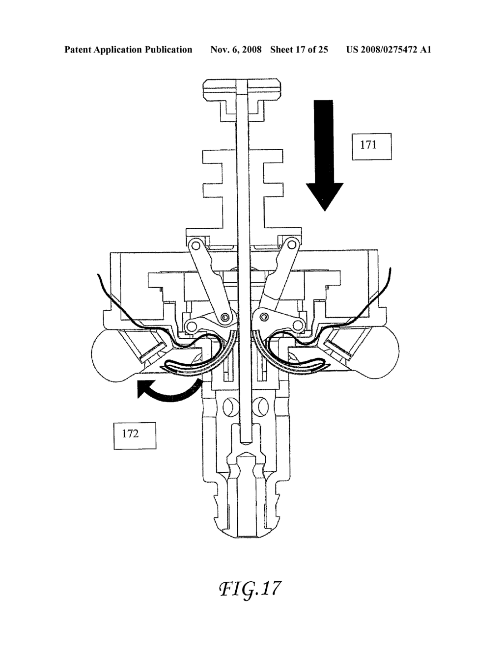 Assisted Apparatus for Anastomosis and Method Thereby of Reconnecting the Urethra to the Bladder After Removal of the Prostate During a Prostatectomy - diagram, schematic, and image 18