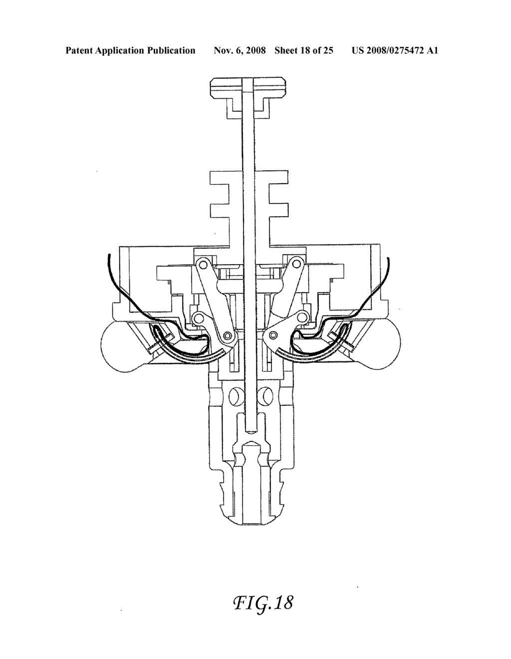 Assisted Apparatus for Anastomosis and Method Thereby of Reconnecting the Urethra to the Bladder After Removal of the Prostate During a Prostatectomy - diagram, schematic, and image 19