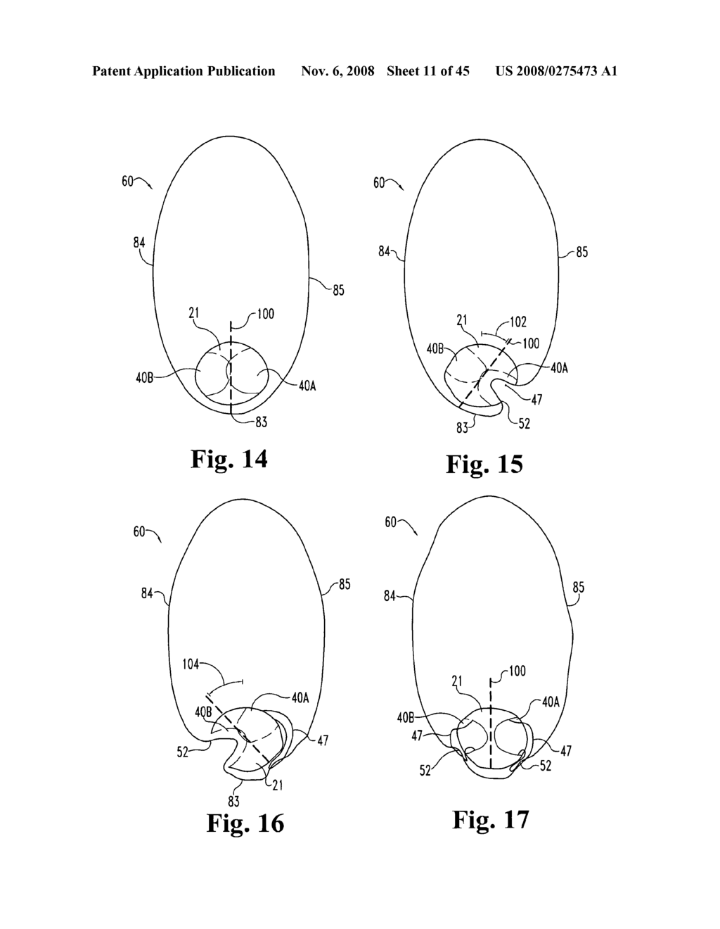 SYSTEMS AND TECHNIQUES FOR MINIMALLY INVASIVE GASTROINTESTINAL PROCEDURES - diagram, schematic, and image 12