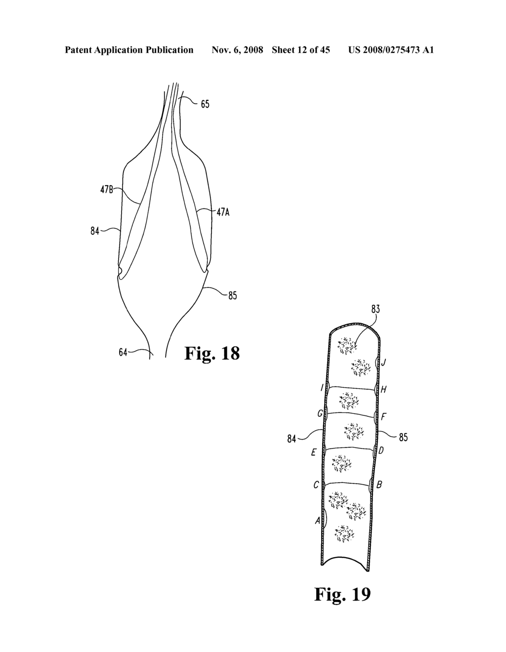 SYSTEMS AND TECHNIQUES FOR MINIMALLY INVASIVE GASTROINTESTINAL PROCEDURES - diagram, schematic, and image 13