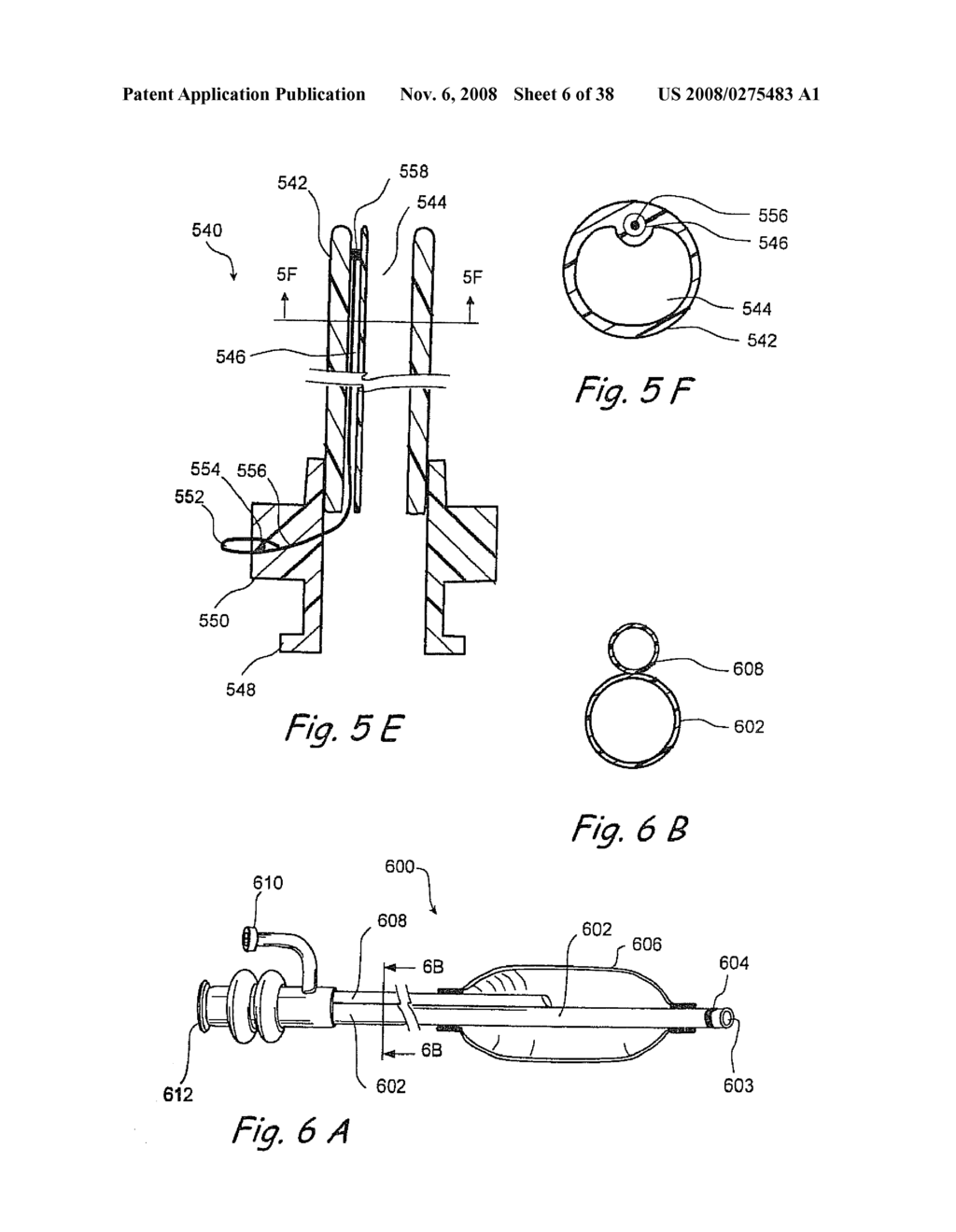 Methods and Apparatus for Treating Disorders of the Ear Nose and Throat - diagram, schematic, and image 07