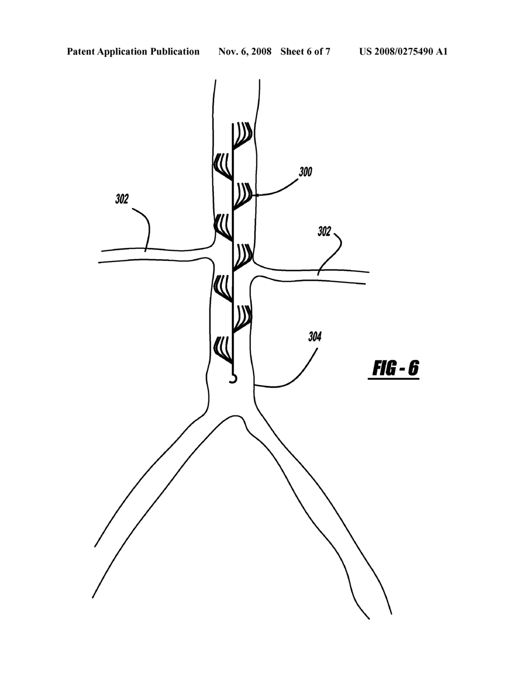 MEDICAL FILTER WITH PARTIAL BASKETS - diagram, schematic, and image 07