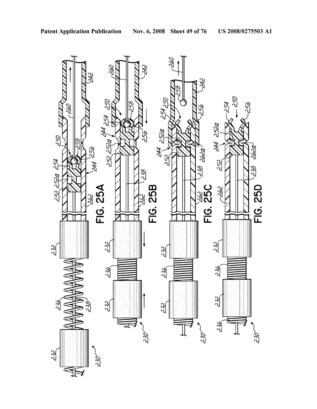 METHOD OF HEART VALVE REPAIR - diagram, schematic, and image 50