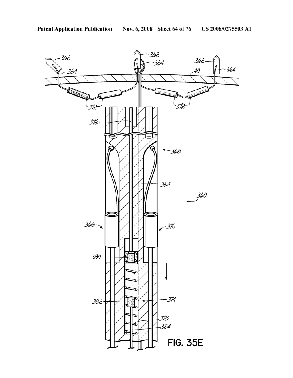 METHOD OF HEART VALVE REPAIR - diagram, schematic, and image 65