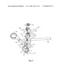 Facet Joint Replacement diagram and image