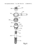 Facet Joint Replacement diagram and image