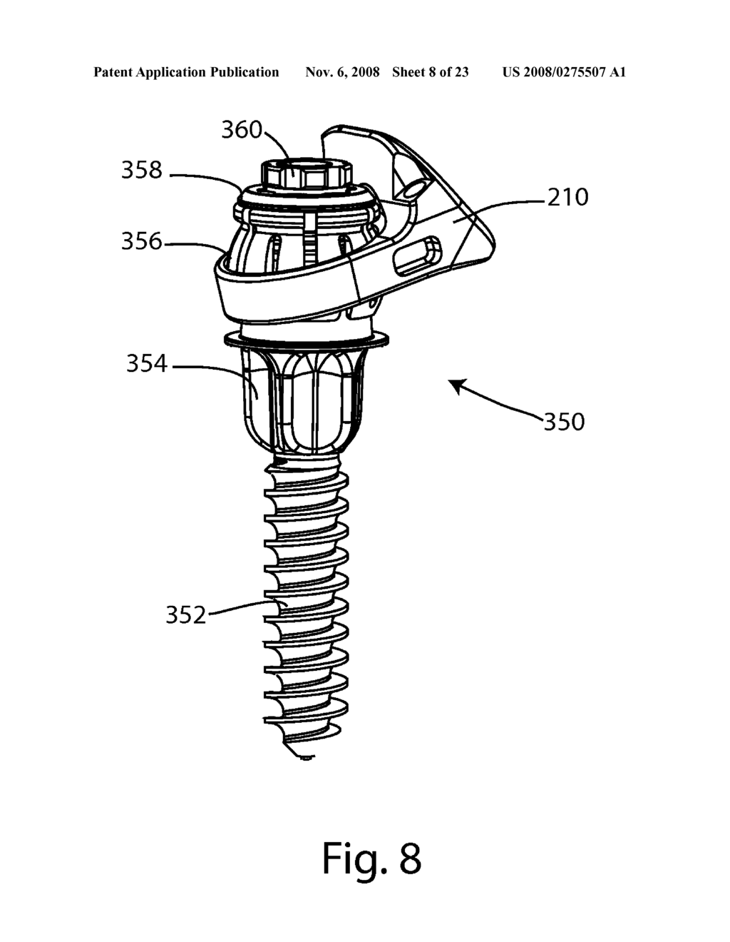 Facet Joint Replacement - diagram, schematic, and image 09