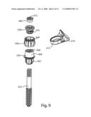 Facet Joint Replacement diagram and image