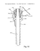 Facet Joint Replacement diagram and image