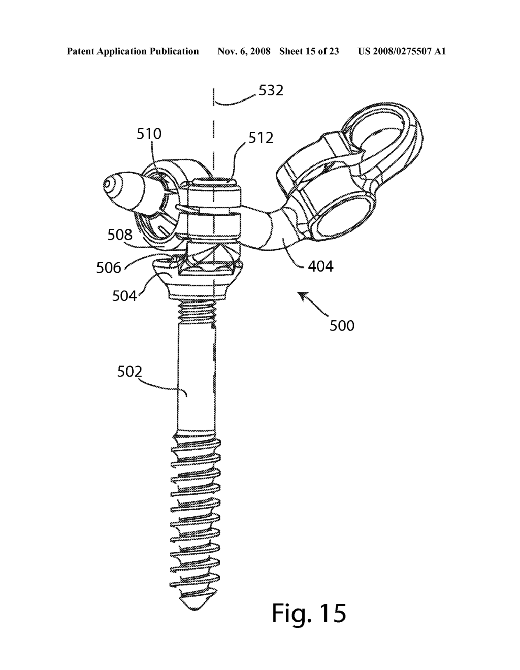 Facet Joint Replacement - diagram, schematic, and image 16